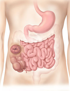 Colostomía ascendente