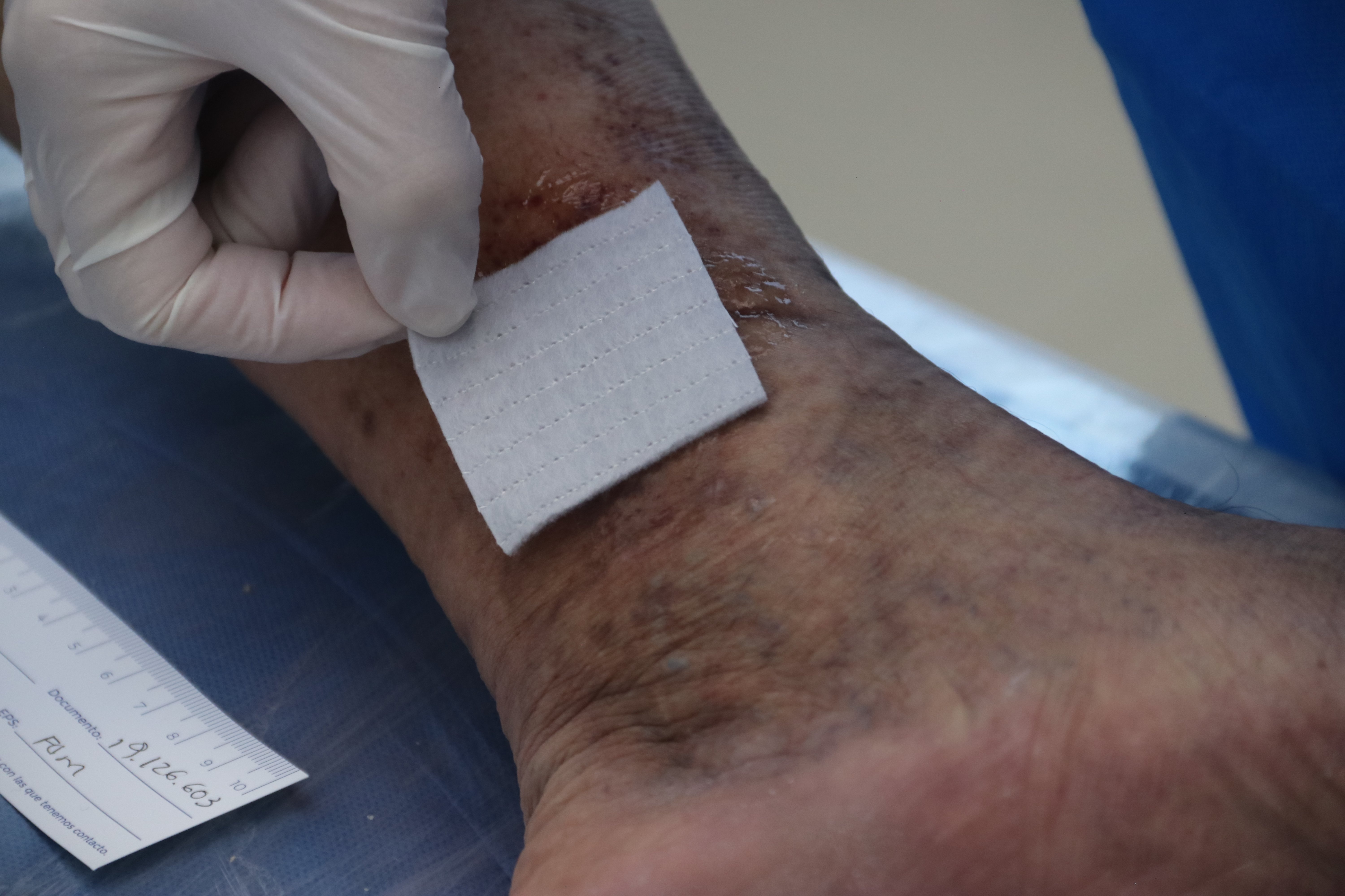 an adhesive bandage on a wound
