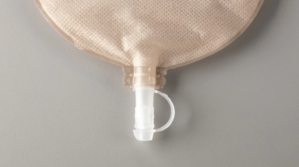 urostomy