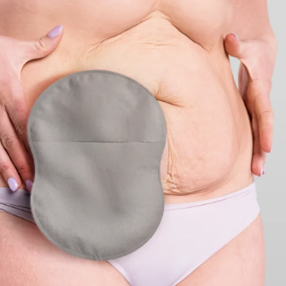 Un primo piano di una donna che utilizza una sacca per stomia a forma di 8 con Leak Defense™.