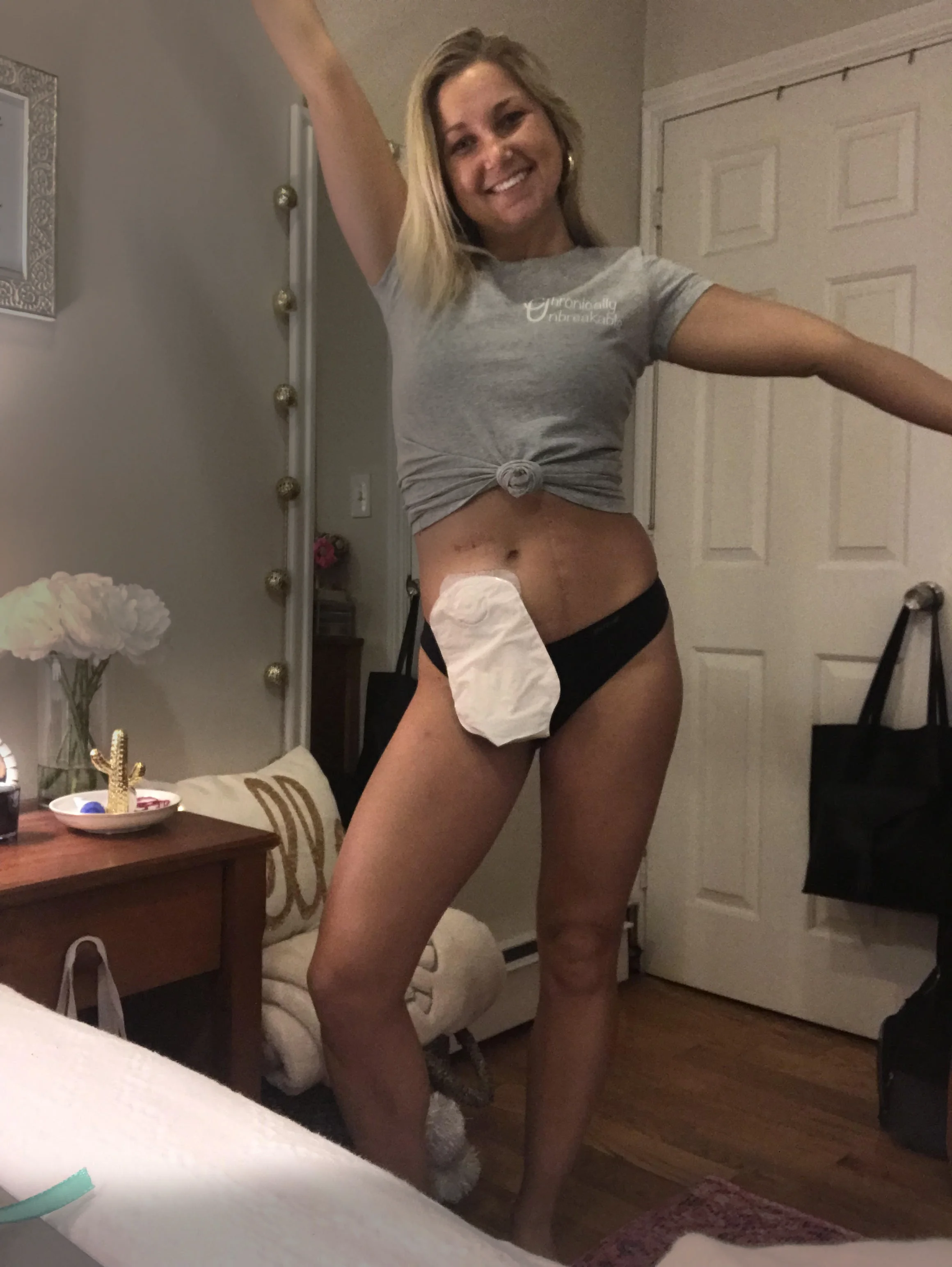 Lady with a stoma