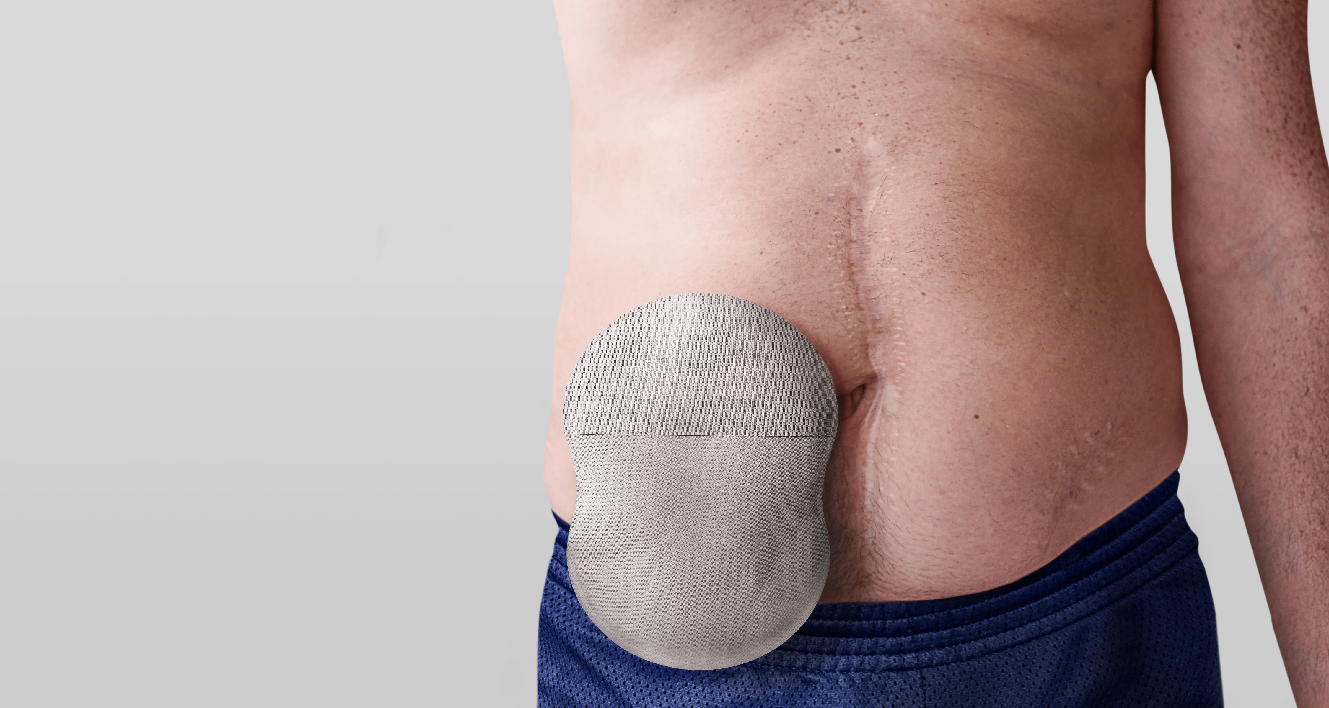Mann med en Esteem Body™ stomipose